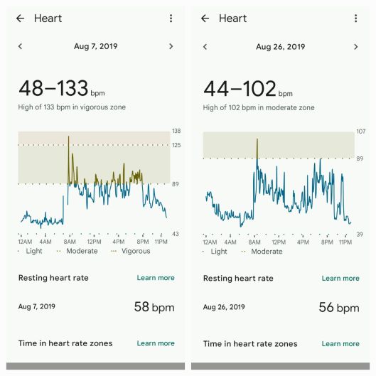 Fitbit screenshots comparing a day before and after surgery
